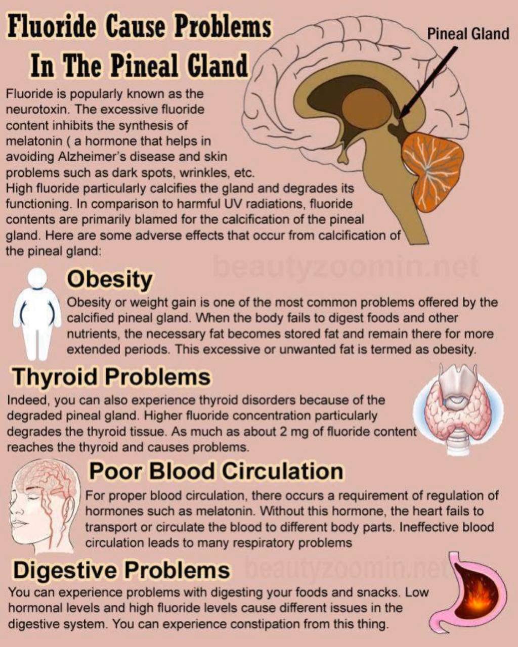 Fluoride Is a Poison